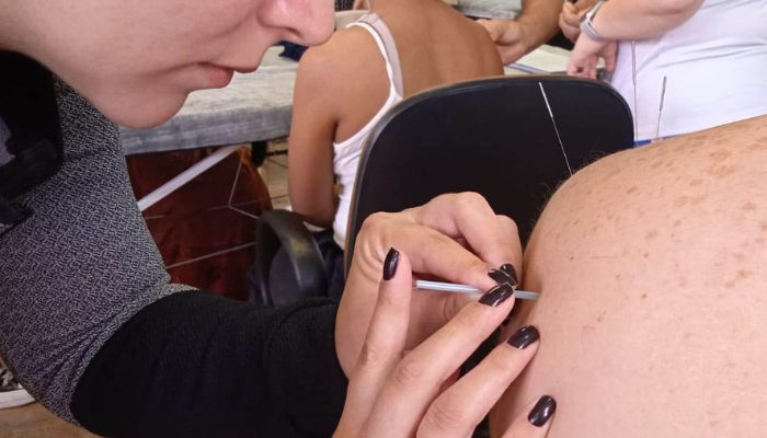 Foto: SESA-PR Acupuntura e meditação no SUS: Paraná registra 69 mil atendimentos de PICS em 2025